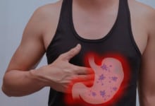 Stomach Cancer