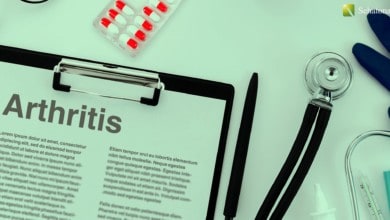 التهاب المفاصل Arthritis